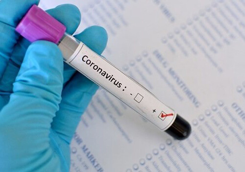 За останню добу в Україні виявлено 11 нових випадків захворювання COVID-19