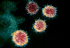 У Штатах науковці вивчили можливість передачі коронавірусу статевим шляхом
