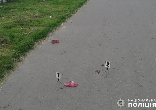 На Хмельниччині 7-річна дівчинка потрапила під колеса автівки