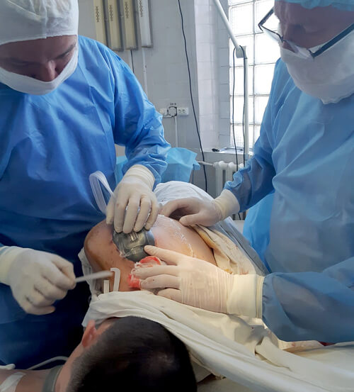 Шепетівська лікарня отримала німецьку систему VAC-терапії