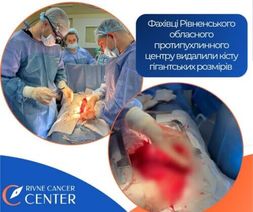 У протипухлинному центрі в сусідній із Хмельниччиною області видалили кісту об’ємом більше 18 літрів