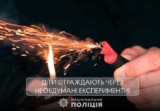 Опіки очей, обличчя та тіла у школяра: експеримент із соцмереж закінчився трагедією