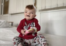 Мозок не мав куди рости: однорічній дитині вперше провели унікальну операцію на черепі