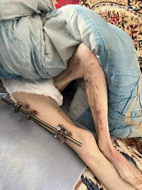 У домі милосердя на Хмельниччині виявили кричущі порушення прав людей похилого віку та осіб з інвалідністю