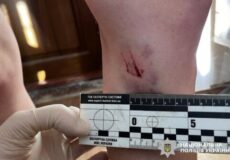 Gloved hand holds a forensic measurement scale up to a leg with a small wound; police insignia visible in the corner.