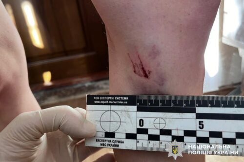Gloved hand holds a forensic measurement scale up to a leg with a small wound; police insignia visible in the corner.